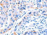 SMG8 Polyclonal Antibody