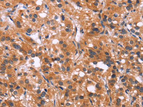 MAPK11 Polyclonal Antibody Store at -20°C