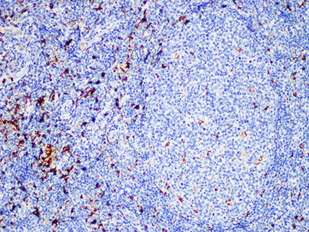Lysozyme Monoclonal Antibody Stored at -20°C