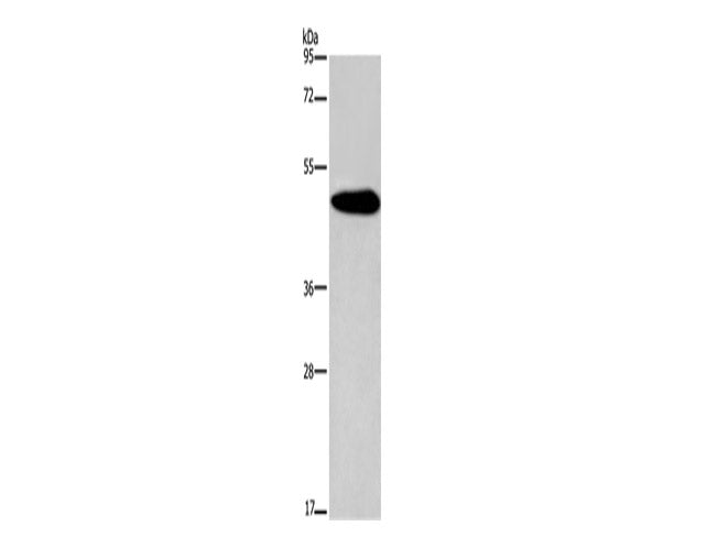 KCNG2 Polyclonal Antibody Store at -20°C