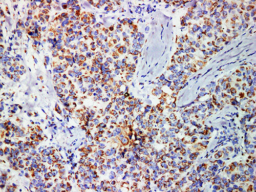 Mammaglobin Monoclonal Antibody stored at 2~8°C