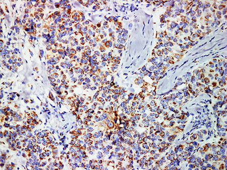 Mammaglobin Monoclonal Antibody stored at 2~8°C