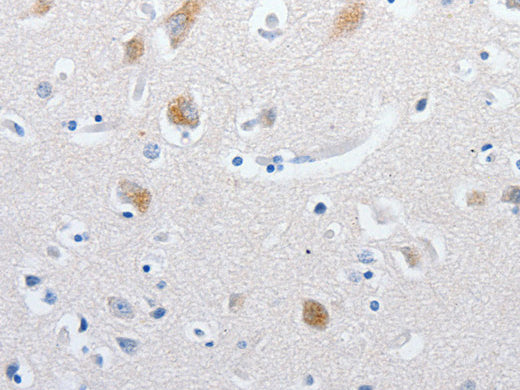 MATN1 Polyclonal Antibody Store at -20°C, Biomarkers, Elabscience Biotechnology, MSE Supplies