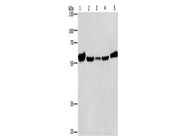 CAT Polyclonal Antibody Store at -20°C