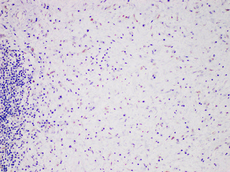 MDM2 Monoclonal Antibody