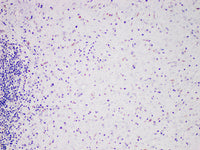 MDM2 Monoclonal Antibody