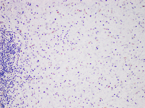 MDM2 Monoclonal Antibody