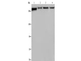 FLNA Polyclonal Antibody Store at -20°C
