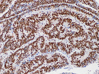 MLH1 Monoclonal Antibody Stored at -20°C