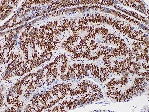 MLH1 Monoclonal Antibody Stored at -20°C
