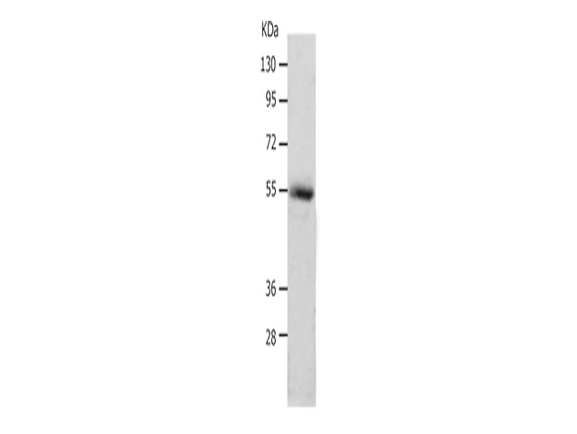 MMP17 Polyclonal Antibody Store at -20°C, Biomarkers, Elabscience Biotechnology, MSE Supplies