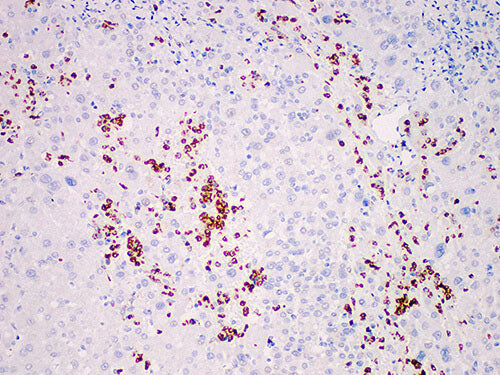 MPO Monoclonal Antibody Stored at 2~8°C