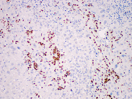 MPO Monoclonal Antibody Stored at 2~8°C