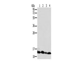 NDUFS5 Polyclonal Antibody