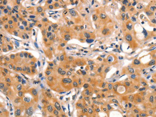 AIM2 Polyclonal Antibody Store at -20°C