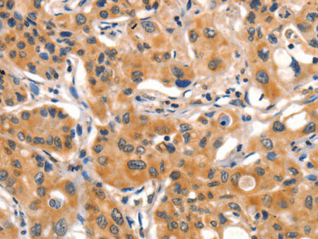 AIM2 Polyclonal Antibody Store at -20°C