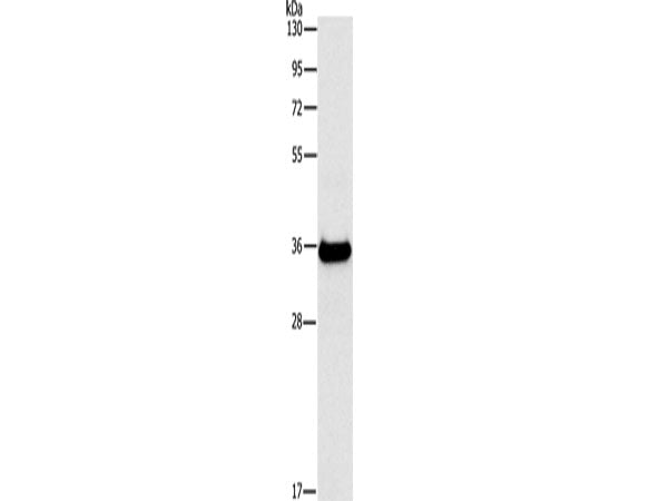 FGL1 Polyclonal Antibody Store at -20°C