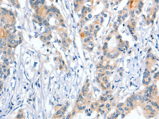 Placental Alkaline Phosphatase Polyclonal Antibody Store at -20°C