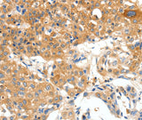PLAT Polyclonal Antibody