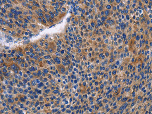 IGSF10 Polyclonal Antibody Store at -20°C