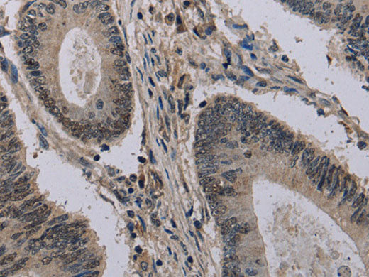 HIST1H2AH Polyclonal Antibody Store at -20°C