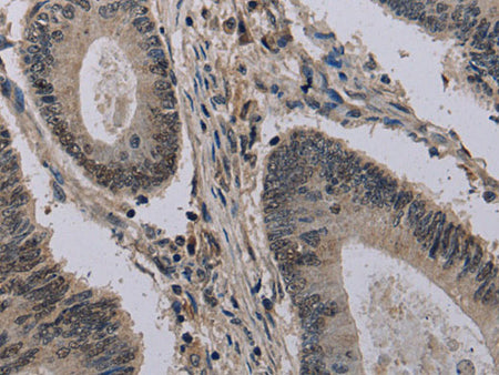 HIST1H2AH Polyclonal Antibody Store at -20°C