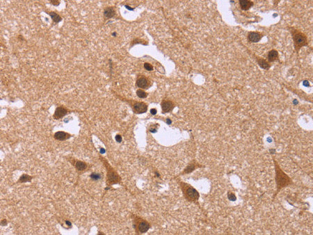 DCBLD2 Polyclonal Antibody Store at -20°C