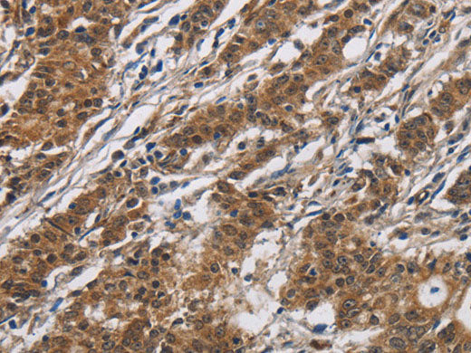 DHRS3 Polyclonal Antibody Store at -20°C
