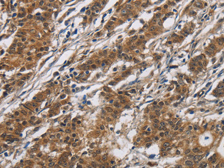 DHRS3 Polyclonal Antibody Store at -20°C