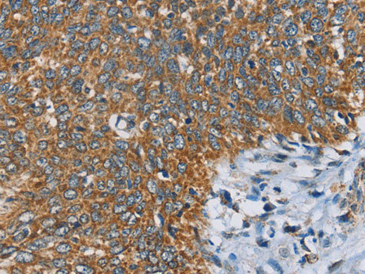 ANKHD1 Polyclonal Antibody Store at -20°C