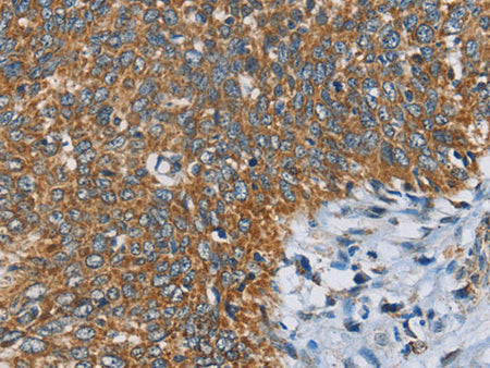 ANKHD1 Polyclonal Antibody Store at -20°C
