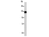 PARP1 Polyclonal Antibody Store at -20°C