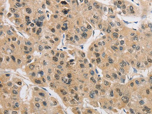AMZ2 Polyclonal Antibody Store at -20°C