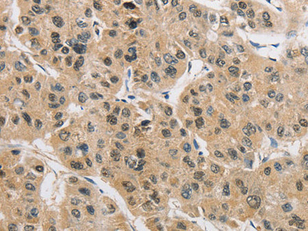 AMZ2 Polyclonal Antibody Store at -20°C