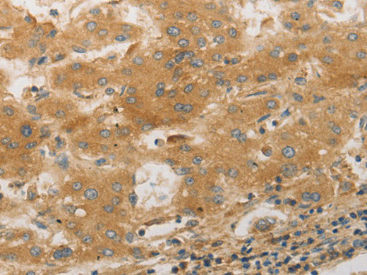 PLPP1 Polyclonal Antibody Store at -20°C