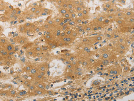 PLPP1 Polyclonal Antibody Store at -20°C
