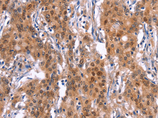 GPR124 Polyclonal Antibody Store at -20°C
