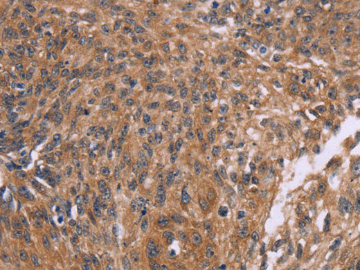CTNNBL1 Polyclonal Antibody Store at -20°C