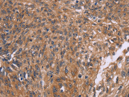 CTNNBL1 Polyclonal Antibody Store at -20°C