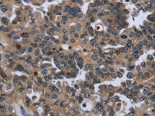 ITGAE Polyclonal Antibody Store at -20°C
