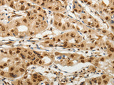SOCS7 Polyclonal Antibody Store at -20°C