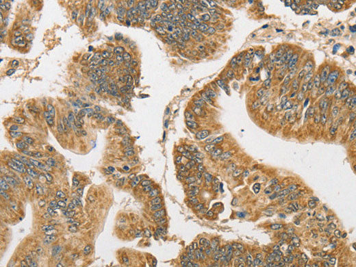 ATG3 Polyclonal Antibody Store at -20°C