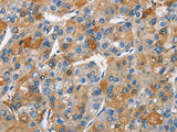 BCL10 Polyclonal Antibody Store at -20°C