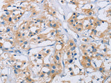 CCR9 Polyclonal Antibody Store at -20°C