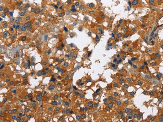 CATSPER3 Polyclonal Antibody