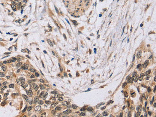 PDLIM7 Polyclonal Antibody Store at -20°C