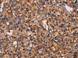 MAP1LC3C Polyclonal Antibody