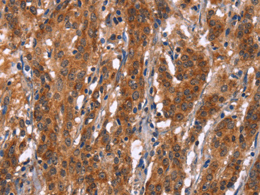 Gphn Polyclonal Antibody Store at -20°C