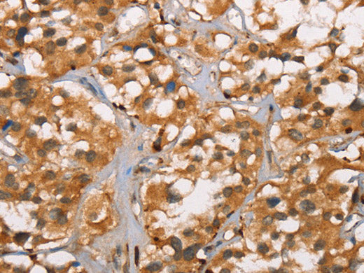 DICER1 Polyclonal Antibody Store at -20°C