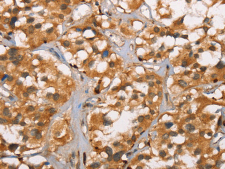 DICER1 Polyclonal Antibody Store at -20°C